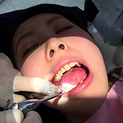 歯フェチ！本物歯治療映像色素沈着研磨除去＆歯石除去