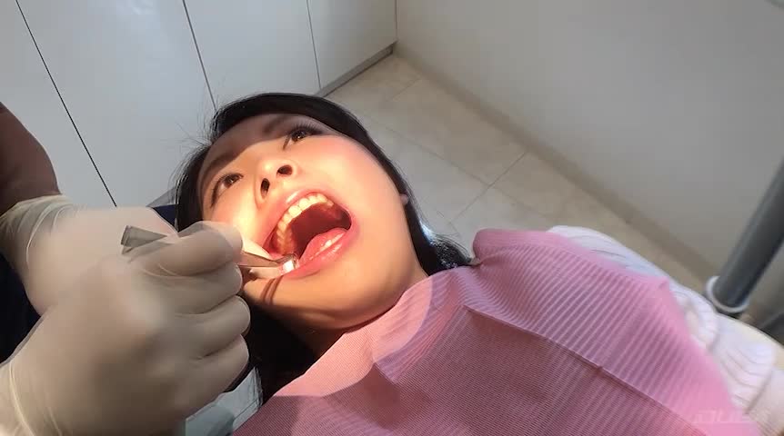 歯フェチ！本物歯治療映像色素沈着研磨除去＆歯石除去クリーニング 梅原葵