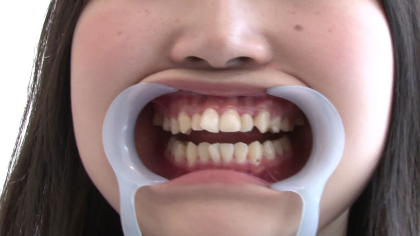 歯フェチ！本物歯治療映像虫歯掘削処置 堀越まき | コアマニアエロ動画DB