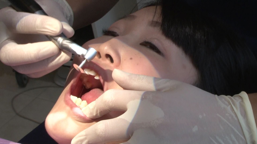 歯フェチ！本物歯治療映像虫歯掘削処置 堀越まき-3