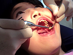 口腔：歯フェチ！本物歯治療映像虫歯掘削処置 堀越まき
