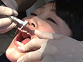 歯フェチ！本物歯治療映像虫歯掘削処置 堀越まき サンプル画像3