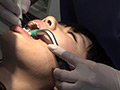 [fetishjapan-0939] 歯フェチ！本物歯科映像 歯石除去 えみ エミのキャプチャ画像 1