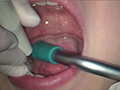 [fetishjapan-0939] 歯フェチ！本物歯科映像 歯石除去 えみ エミのキャプチャ画像 3