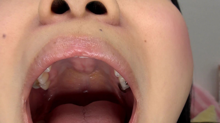 歯フェチ！相互口内観察レズ銀歯あり！ | DUGAエロ動画データベース