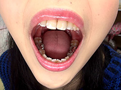 口腔：歯フェチ！相互口内観察レズ銀歯あり！
