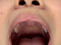 [fetishjapan-0967] 歯フェチ！相互口内観察レズ銀歯あり！のキャプチャ画像 1