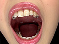 歯フェチ！相互口内観察レズ銀歯あり！ サンプル画像3
