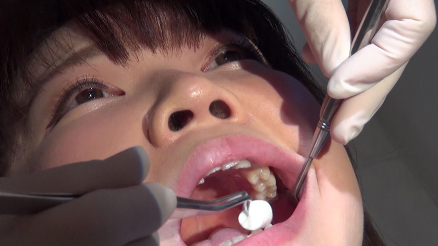 歯フェチ！本物歯科治療映像 【歯観察+虫歯治療映像+フッ素加工】井野紅葉