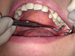 口腔：歯フェチ！本物歯科治療映像 井野紅葉