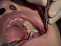 [fetishjapan-0971] 歯フェチ！本物歯科治療映像 井野紅葉のキャプチャ画像 5