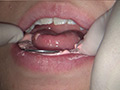[fetishjapan-0971] 歯フェチ！本物歯科治療映像 井野紅葉のキャプチャ画像 9