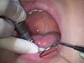 [fetishjapan-0971] 歯フェチ！本物歯科治療映像 井野紅葉のキャプチャ画像 10