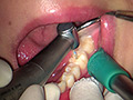 [fetishjapan-0972] 歯フェチ！本物歯科治療映像 安田ななは