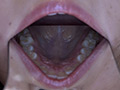 歯フェチ！本物歯科治療映像 安田ななは サンプル画像1