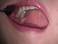 歯フェチ！本物歯科治療映像 安田ななは サンプル画像3