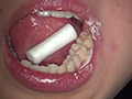 歯フェチ！本物歯科治療映像 安田ななは サンプル画像5