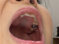 歯観察 放置崩壊歯をいじくってみた涼宮凛 サンプル画像2