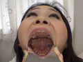 [fetishjapan-0976] 歯観察 放置崩壊歯をいじくってみた涼宮凛のキャプチャ画像 5
