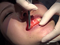 [fetishjapan-0998] 歯科治療映像 柏木茉奈 前編・中篇・後編 フルセット！のキャプチャ画像 4