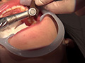 [fetishjapan-0998] 歯科治療映像 柏木茉奈 前編・中篇・後編 フルセット！のキャプチャ画像 8