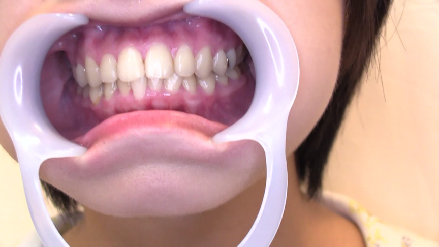 歯科治療映像 石川みなみ-2