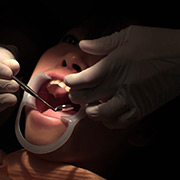 歯科治療映像 石川みなみ