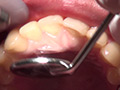 歯科治療映像 石川みなみ 画像3