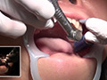 歯科治療映像 石川みなみ 画像4
