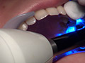 歯科治療映像 石川みなみ 画像5