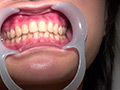 歯科治療映像 石川みなみ 画像7