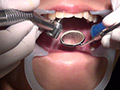 歯科治療映像 石川みなみ 画像8