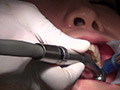 歯科治療映像 石川みなみ 画像9