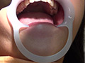 歯科治療映像 石川みなみ 画像10