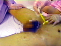 美人女医とエロ看護婦の逆変態レイプ診察のサンプル画像5