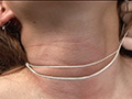 絞め動脈の連鎖に顔面と蒼白 サンプル画像8