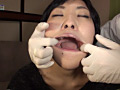 口腔ドキュメント 歯列矯正中の女 美紀・21歳