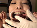 口腔ドキュメント 歯列矯正中の女 美紀・21歳（矯正5年目）のサンプル画像12
