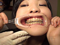 口腔ドキュメント 歯列矯正中の女 美紀・21歳 サンプル画像13