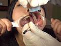 口腔ドキュメント 歯列矯正中の女 美紀・21歳（矯正5年目）のサンプル画像17
