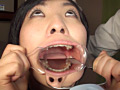 口腔ドキュメント 歯列矯正中の女 美紀・21歳（矯正5年目）のサンプル画像19