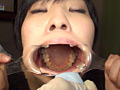 口腔ドキュメント 歯列矯正中の女 美紀・21歳（矯正5年目）のサンプル画像20