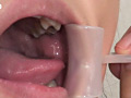 口腔咀嚼診察 粘膜剥き出し！！開口器美女 高沢沙耶のサンプル画像2