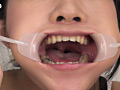 [gripav-0035] 口腔咀嚼診察 粘膜剥き出し！！開口器美女 高沢沙耶のキャプチャ画像 5