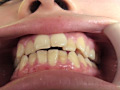 フェチ選！！ 口腔歯科淫診のサンプル画像2