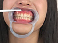 フェチ選！！ 口腔歯科淫診のサンプル画像7