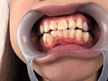 フェチ選！！ 口腔歯科淫診のサンプル画像9