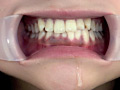 フェチ選！！ 口腔歯科淫診のサンプル画像13