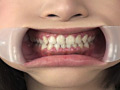 フェチ選！！ 口腔歯科淫診のサンプル画像17