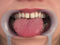 フェチ選！！ 口腔歯科淫診のサンプル画像19